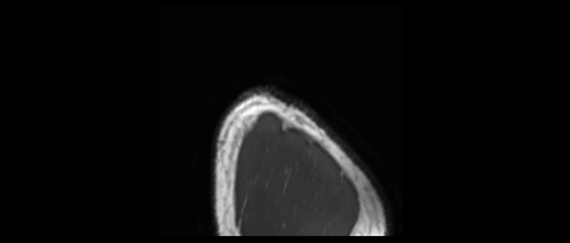 shoulder ligaments sagittal  cross sectional anatomy 3T MRI AI enhanced radiology image -img-00001-00064.webp